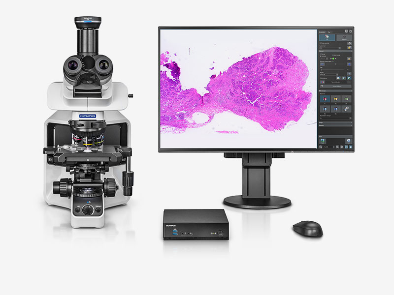 [5631014] Microscope camera, Olympus DP28 w. DP2-AOU Stand-Alone Unit, 8.9 MPx, 1", Color